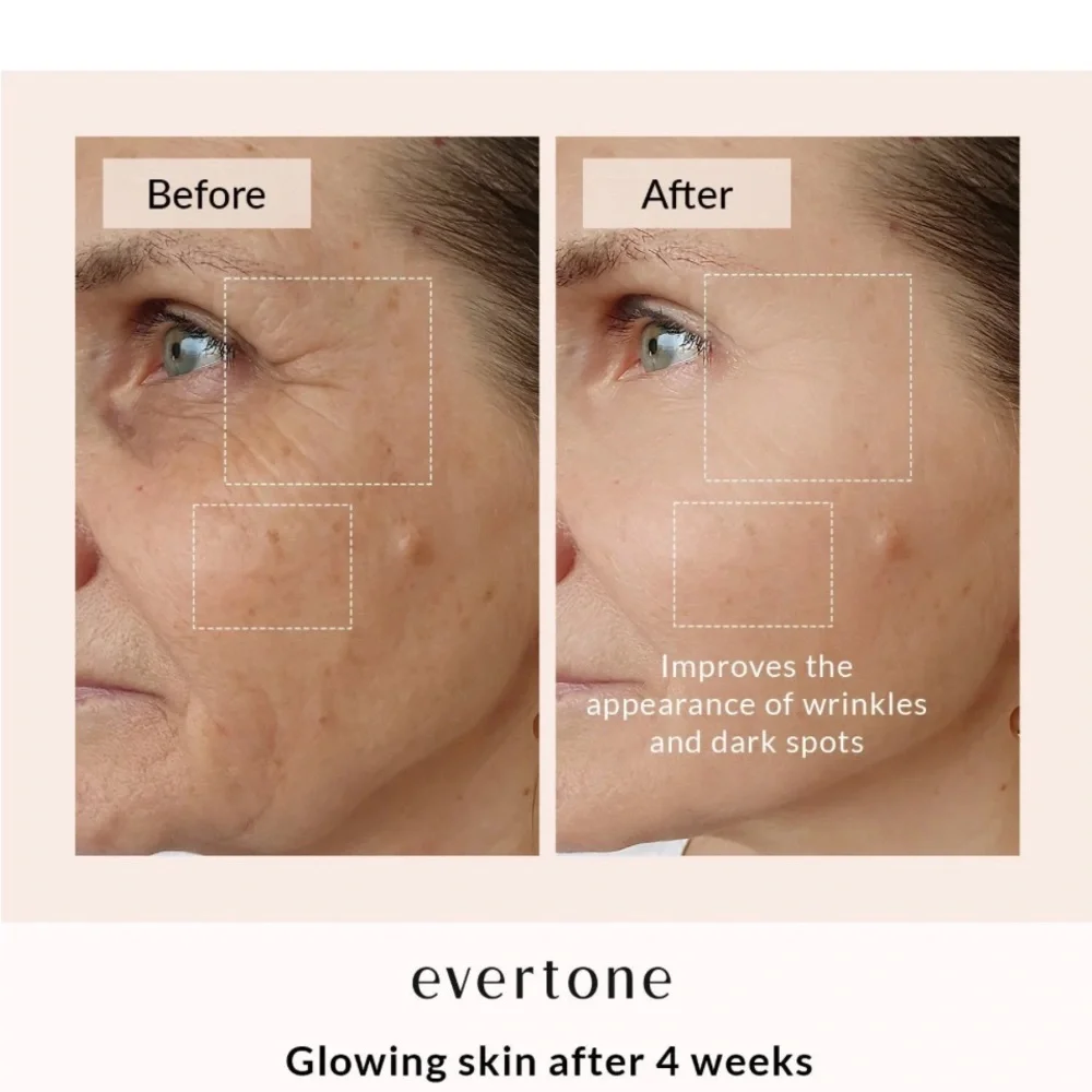 Great used condition, Evertone OMNIGLOW LED FACE & Neck mask. 7 LED colors - Picture 9 of 12